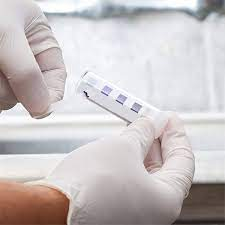 sanitizer testing strips